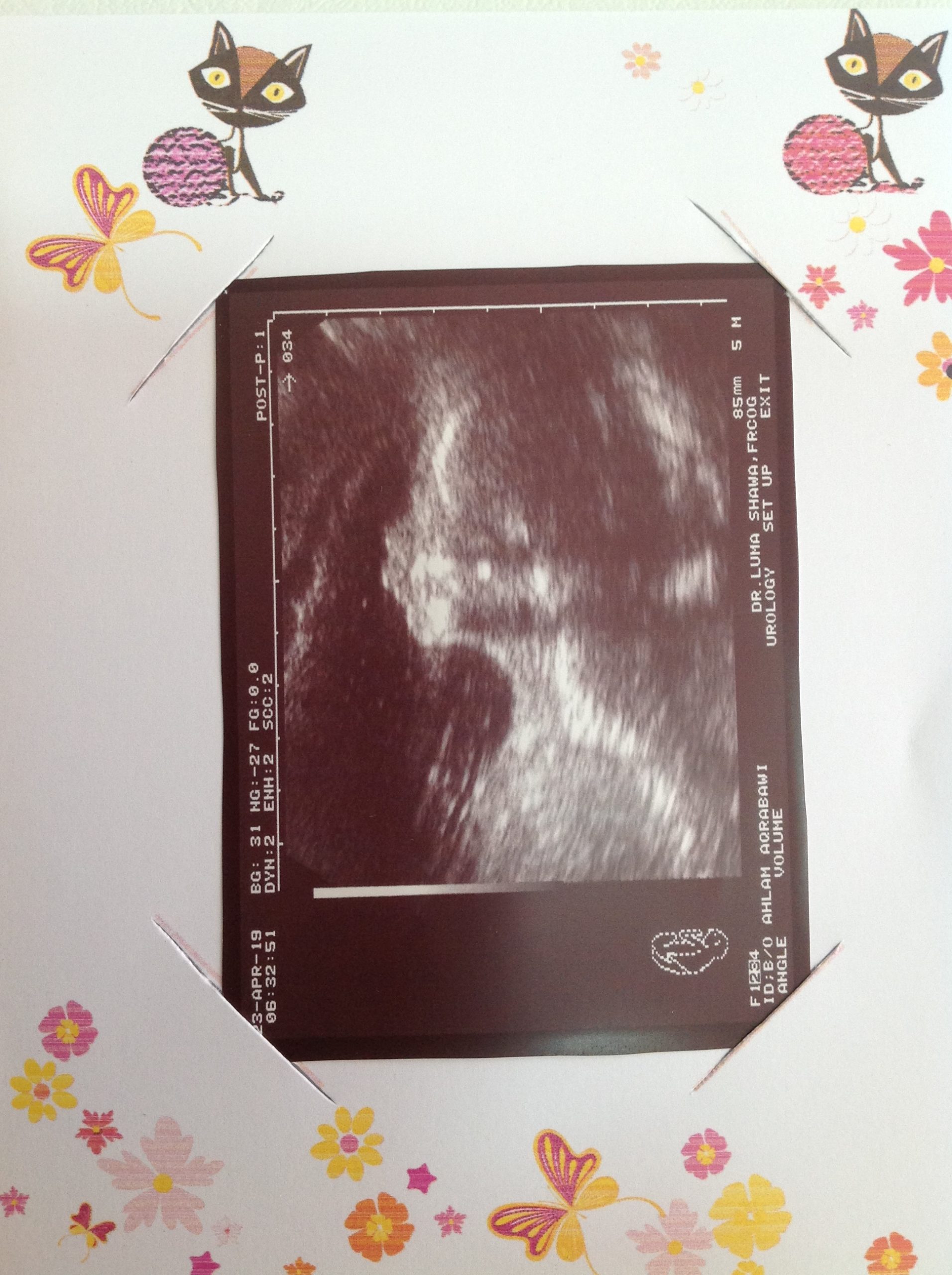 صورة بيبي من اليوم مشوارك مع صحتِك