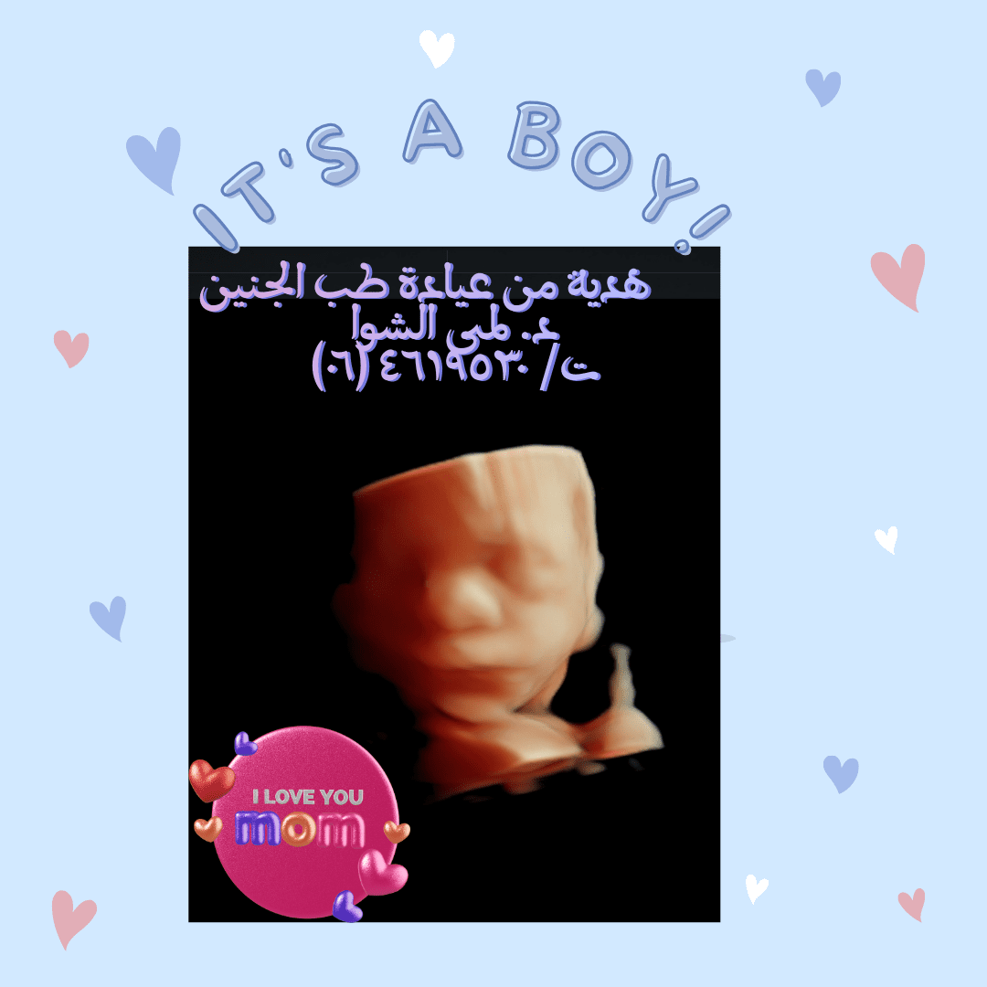 فيديو موسيقي لصور الجنين